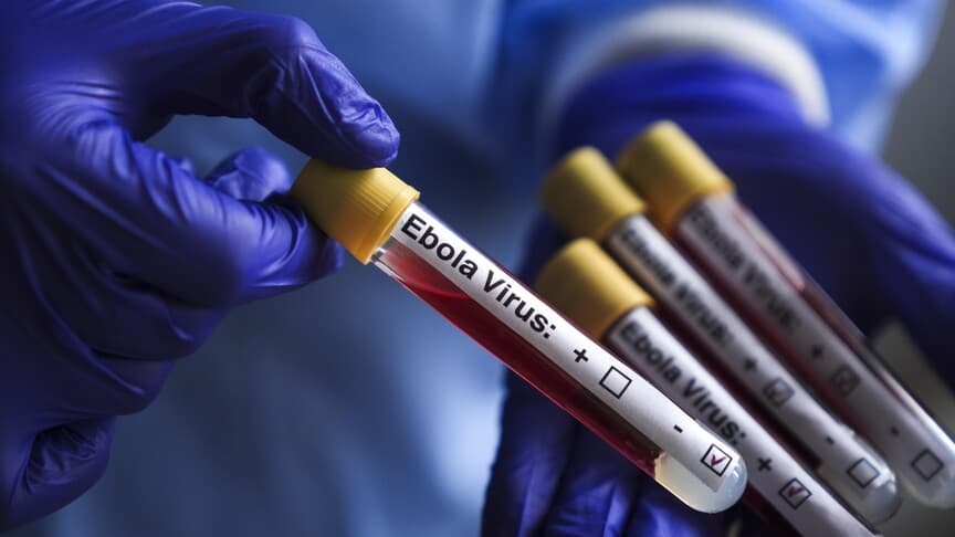 ABD, Kongo'daki Ebola Salgını Nedeniyle Vatandaşları İçin Dönüş Kısıtlaması Getirdi