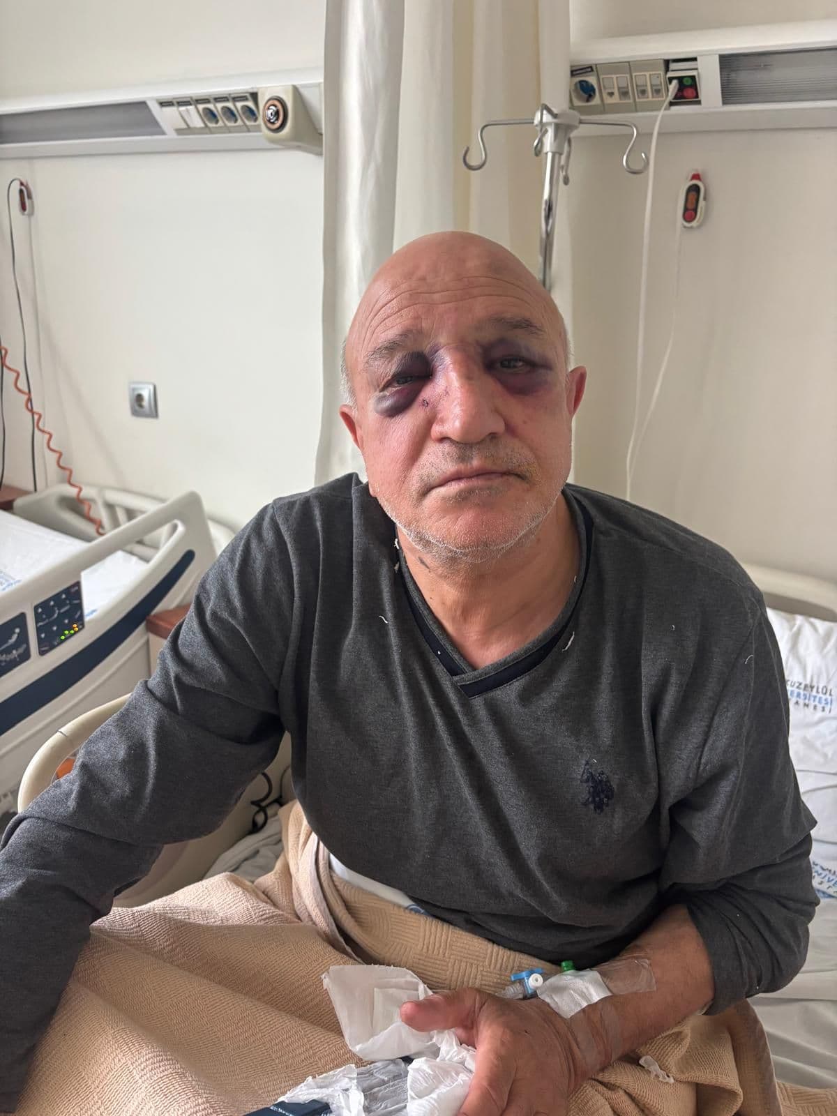 İzmir’de esnaf odası başkanı Kadir Yıldırım’a saldırı